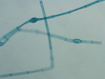 MISSING THUMBNAIL